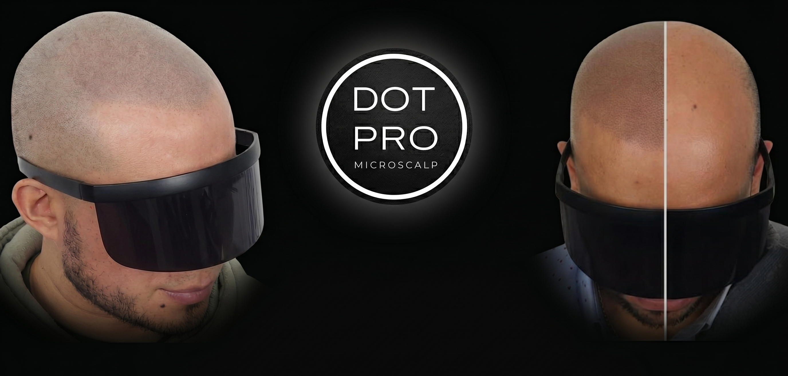 Banner Dotpro micropigmentacion cambio alopecia micro pigmentacion rapado pelado efecto 